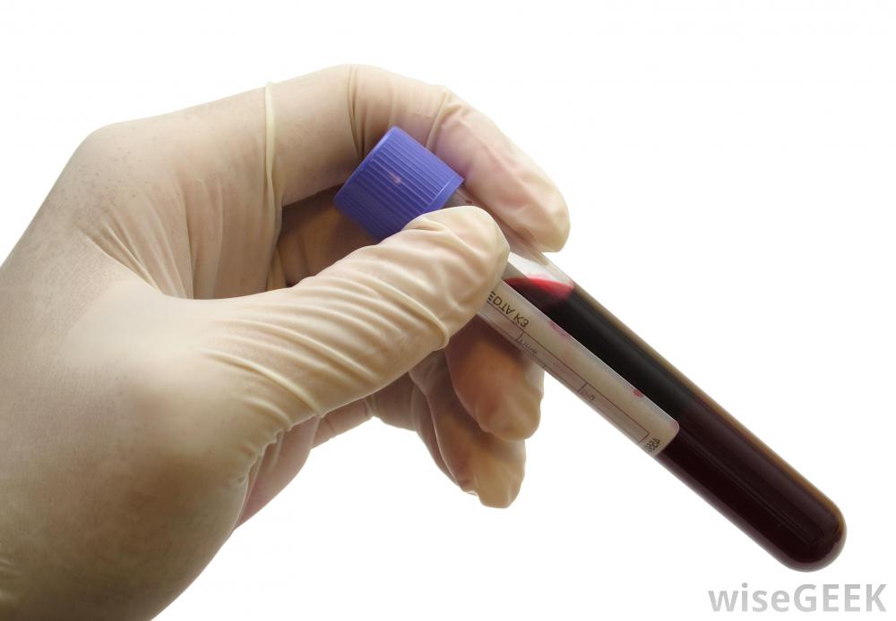 blood vial